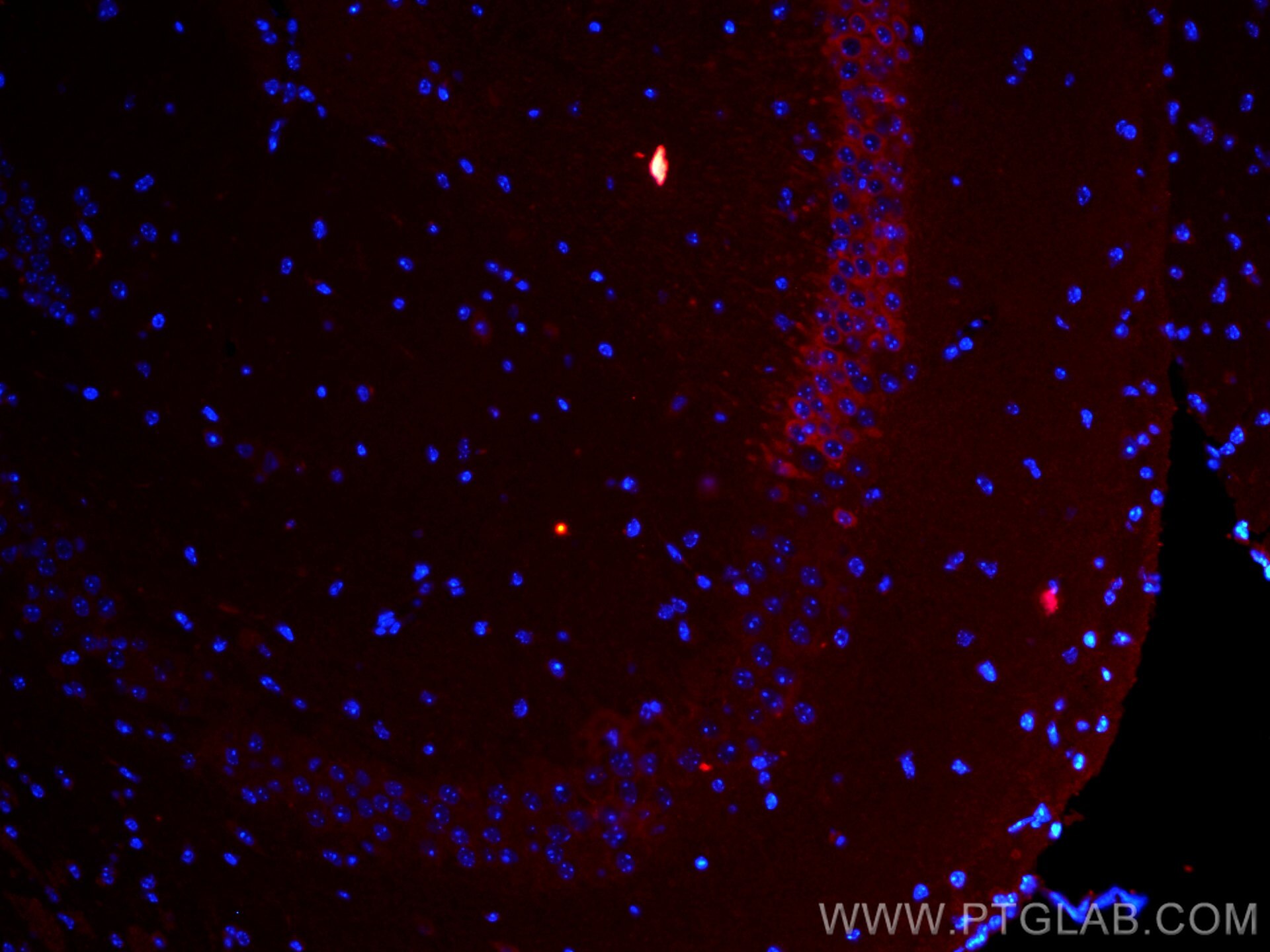 Immunofluorescence (IF) / fluorescent staining of mouse brain tissue using CoraLite®594-conjugated WFS1 Polyclonal antibody (CL594-11558)