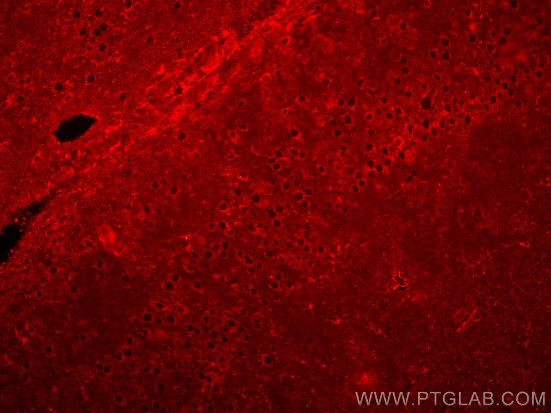 Immunofluorescence (IF) / fluorescent staining of mouse brain tissue using CoraLite® Plus 594-conjugated WFS1 Polyclonal anti (CL594-26995)