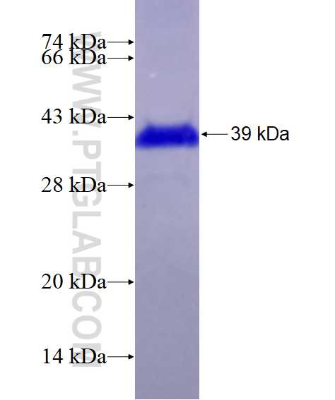 WFS1 fusion protein Ag25724 SDS-PAGE