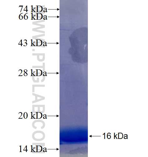 WFS1 fusion protein Ag25735 SDS-PAGE