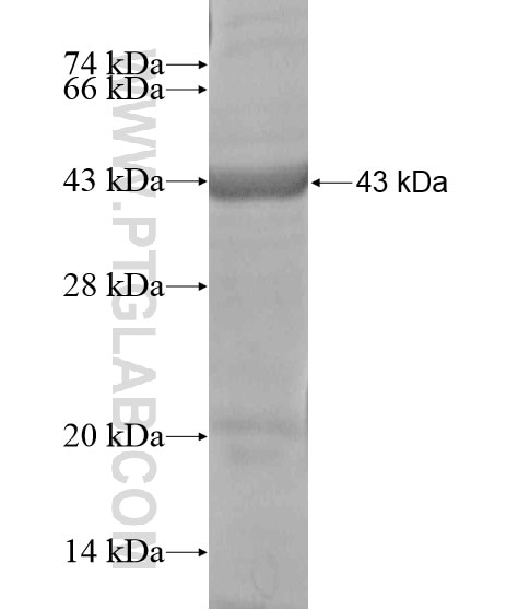 WFS1 fusion protein Ag18826 SDS-PAGE