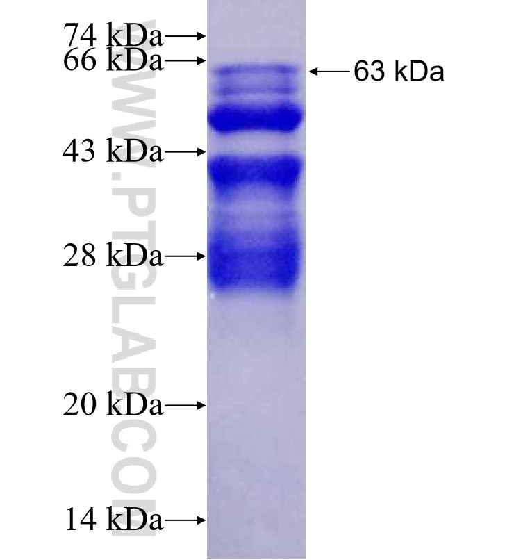 WFS1 fusion protein Ag2114 SDS-PAGE