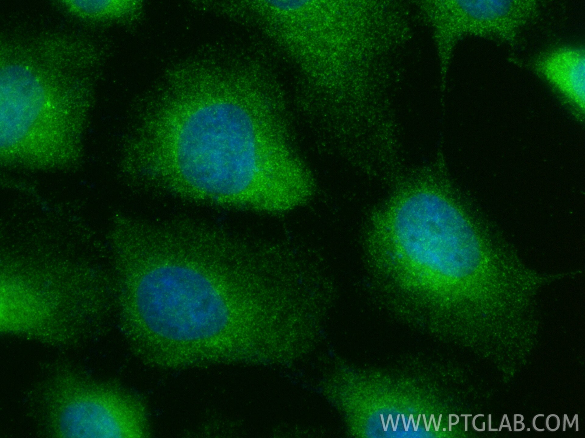 Immunofluorescent analysis of (-20°C Methanol) fixed A431 cells using WHAMM antibody (31572-1-AP) at dilution of 1:200 and CoraLite®488-Conjugated Goat Anti-Rabbit IgG(H+L) (SA00013-2). Immunofluorescence (IF) / fluorescent staining of A431 cells using WHAMM Polyclonal antibody (31572-1-AP)