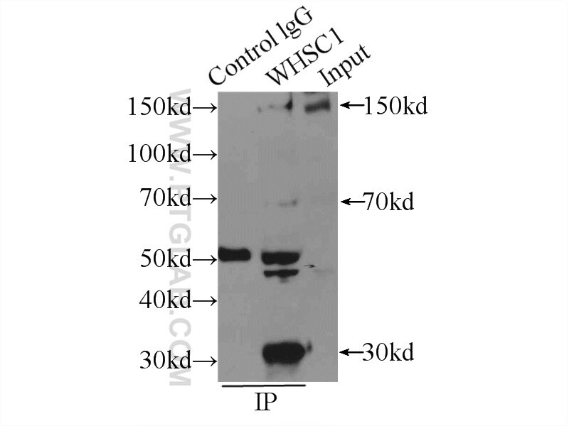 Immunoprecipitation (IP) experiment of HeLa cells using WHSC1 Polyclonal antibody (22722-1-AP)