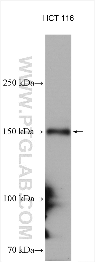 Western Blot (WB) analysis of HCT 116 cells using WHSC1 Polyclonal antibody (22722-1-AP)