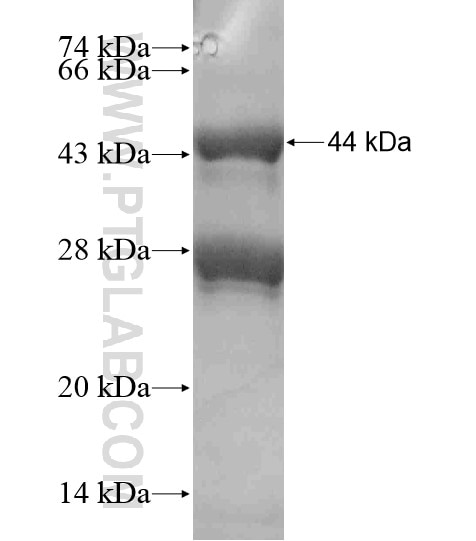 WHSC1 fusion protein Ag18611 SDS-PAGE
