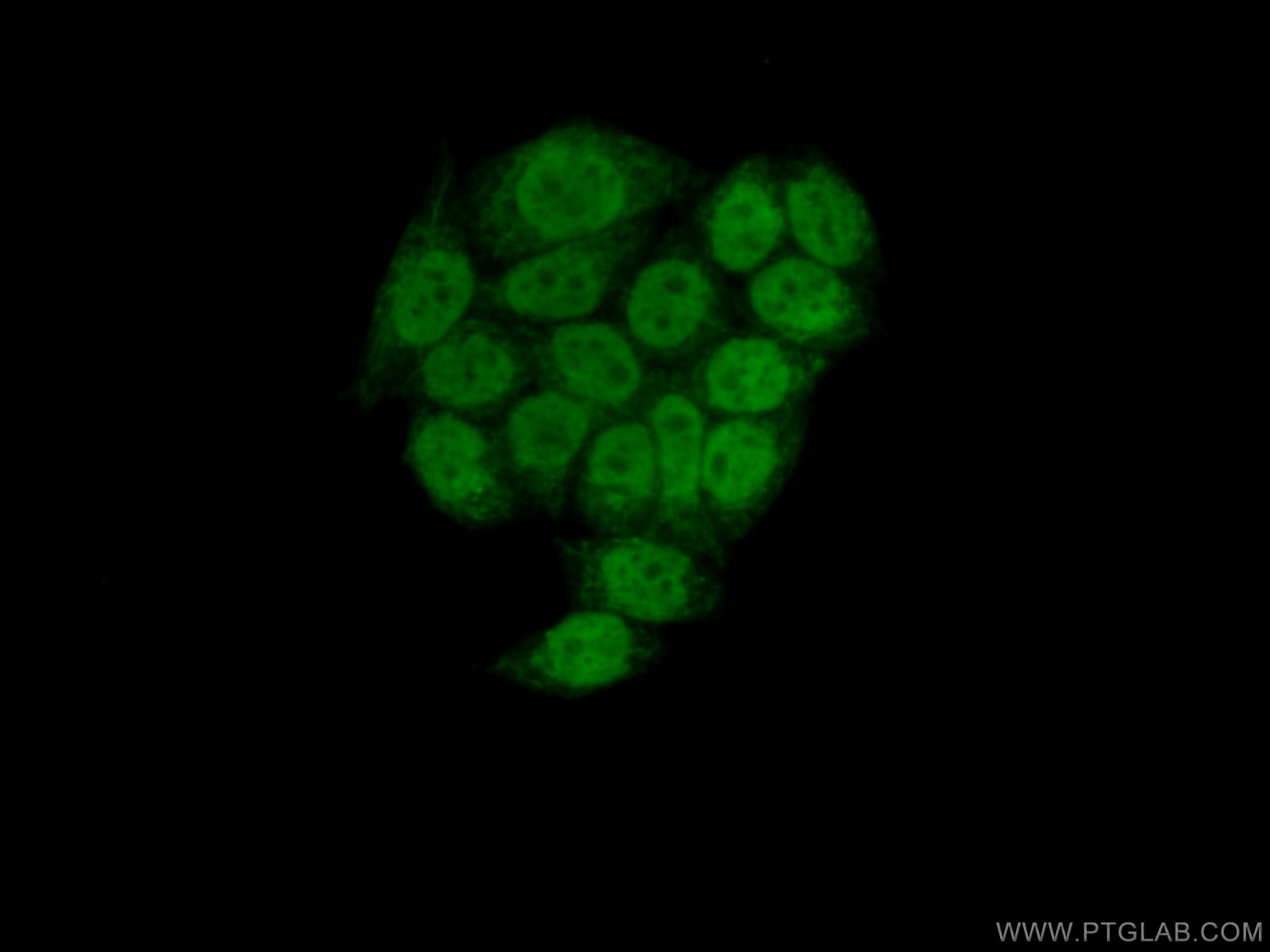 Immunofluorescence (IF) / fluorescent staining of HeLa cells using NSD3 Polyclonal antibody (11345-1-AP)