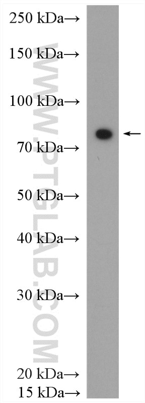Western Blot (WB) analysis of rat heart tissue using NSD3 Polyclonal antibody (11345-1-AP)