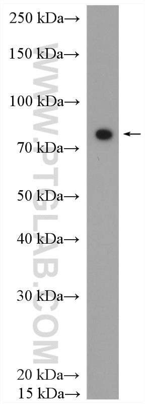 WB analysis of rat heart using 11345-1-AP