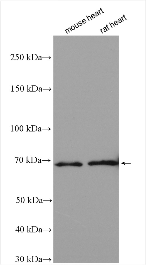 Western Blot (WB) analysis of various lysates using NSD3 Polyclonal antibody (11345-1-AP)