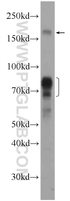 Western Blot (WB) analysis of HeLa cells using NSD3 Polyclonal antibody (11345-1-AP)