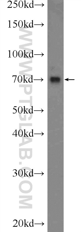 Western Blot (WB) analysis of HEK-293 cells using NSD3 Polyclonal antibody (11345-1-AP)