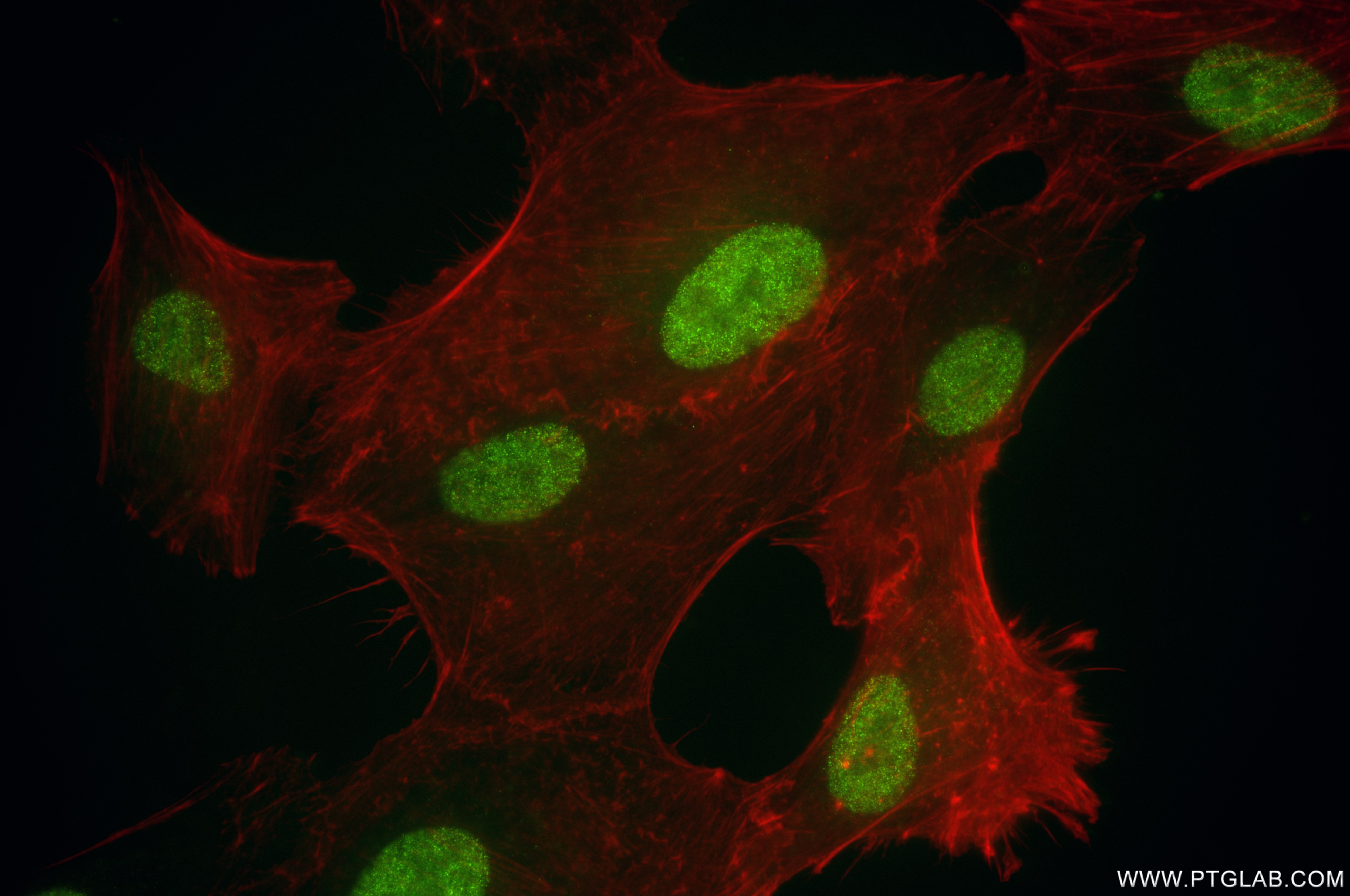 Immunofluorescence (IF) / fluorescent staining of A549 cells using NSD3 Recombinant antibody (83116-2-RR)
