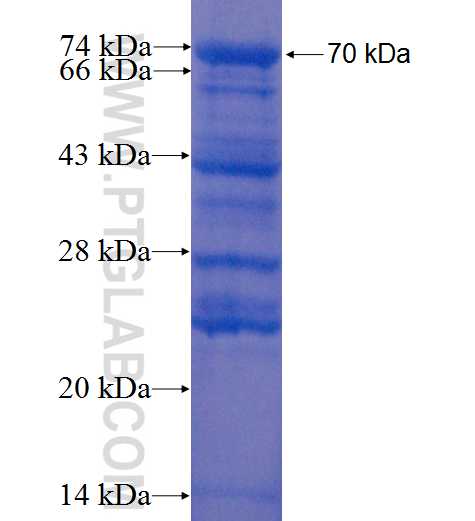 WHSC1L1 fusion protein Ag1894 SDS-PAGE