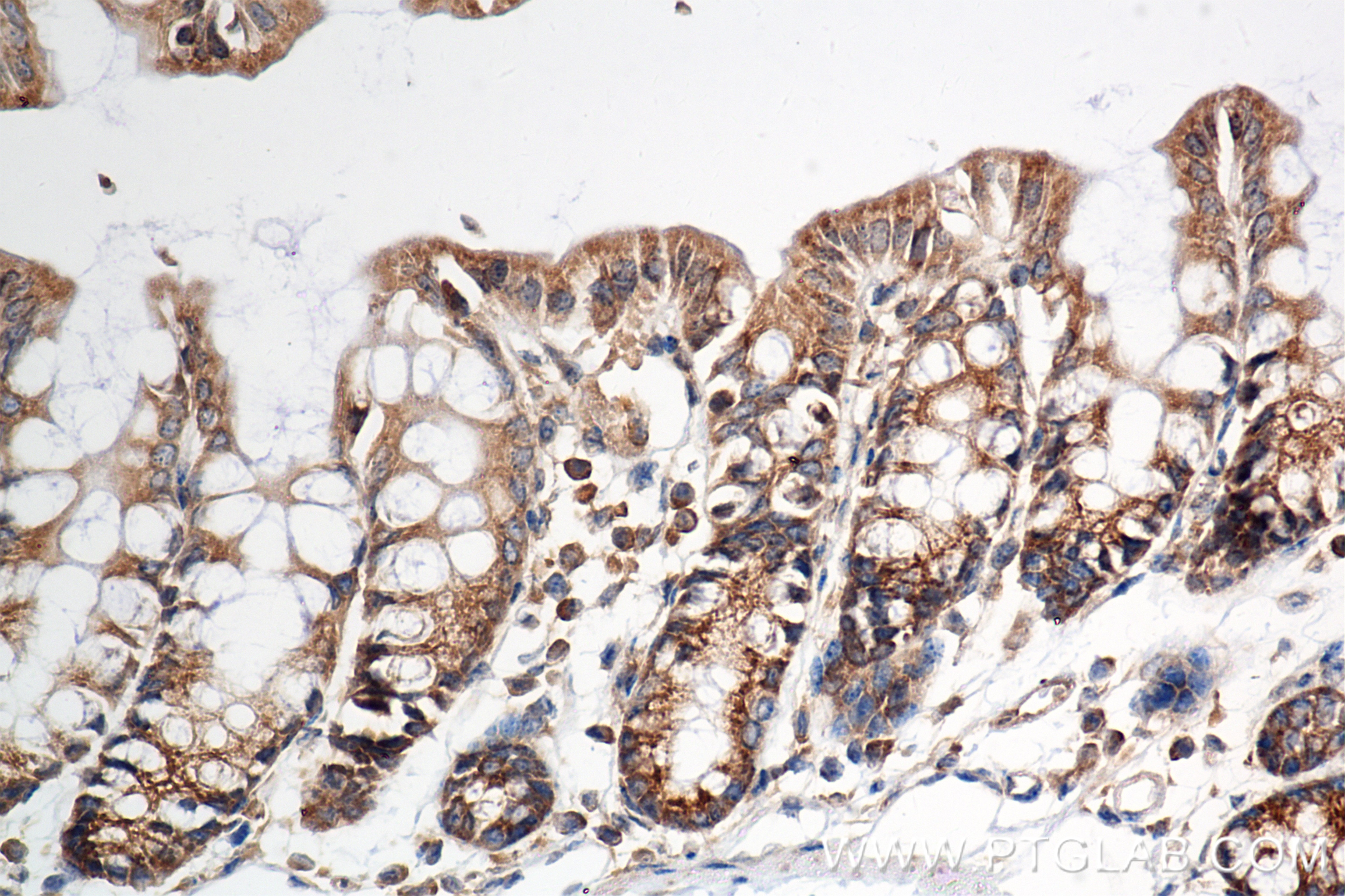 Immunohistochemistry (IHC) staining of mouse colon tissue using WIBG Recombinant antibody (86064-1-RR)