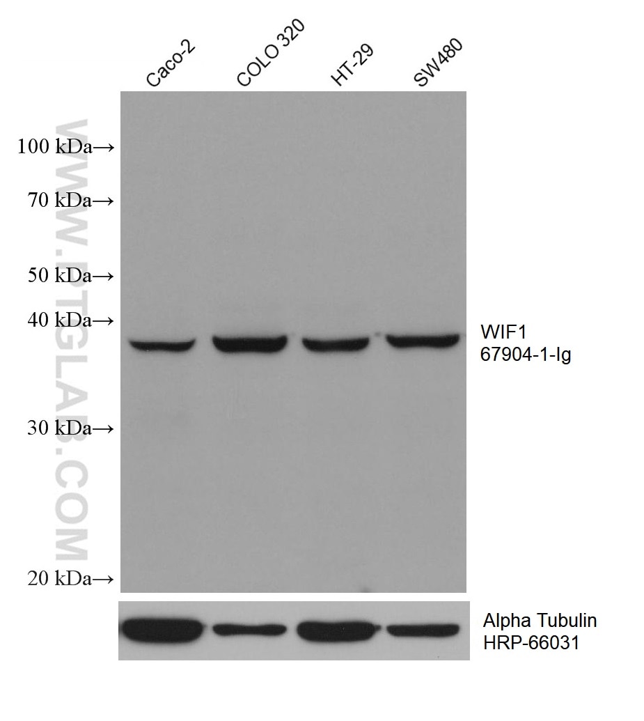 WB analysis using 67904-1-Ig