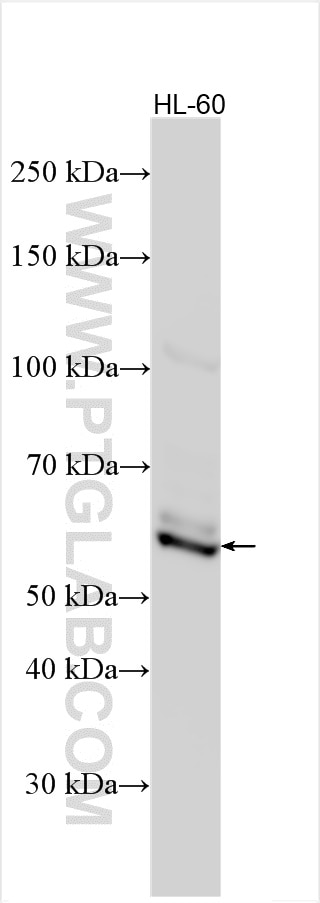 Western Blot (WB) analysis of various lysates using WIPF1 Polyclonal antibody (22047-1-AP)