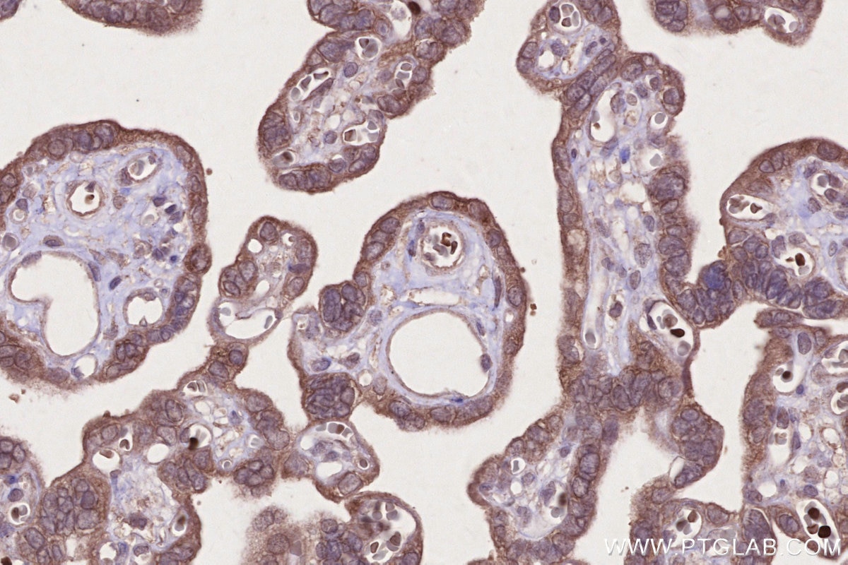 Immunohistochemistry (IHC) staining of human placenta tissue using WIPF2 Polyclonal antibody (20512-1-AP)