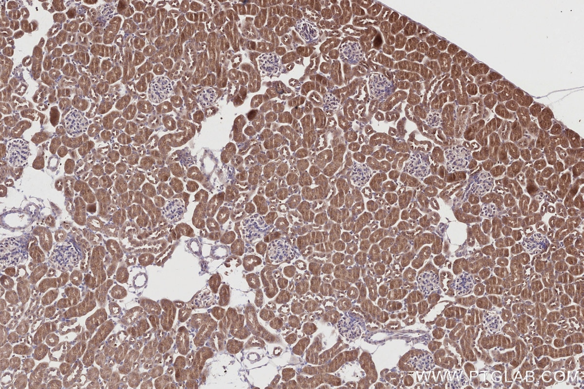 Immunohistochemistry (IHC) staining of mouse kidney tissue using WIPF2 Polyclonal antibody (20512-1-AP)