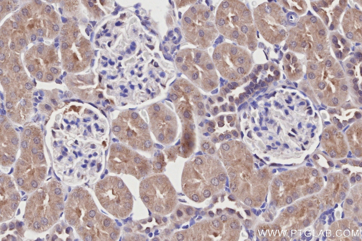 Immunohistochemistry (IHC) staining of rat kidney tissue using WIPF2 Polyclonal antibody (20512-1-AP)