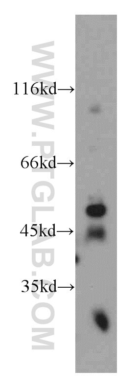 Western Blot (WB) analysis of mouse brain tissue using WIPF2 Polyclonal antibody (20512-1-AP)