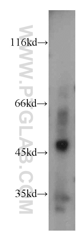 Western Blot (WB) analysis of mouse colon tissue using WIPF2 Polyclonal antibody (20512-1-AP)