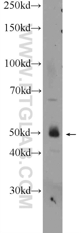 Western Blot (WB) analysis of SW 1990 cells using WIPI1 Polyclonal antibody (25204-1-AP)