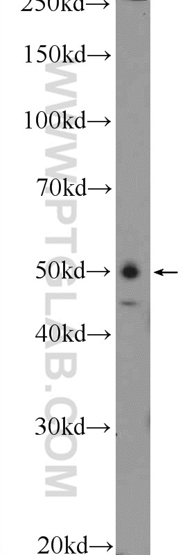 Western Blot (WB) analysis of HEK-293 cells using WIPI1 Polyclonal antibody (25204-1-AP)