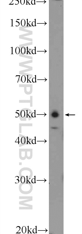 Western Blot (WB) analysis of HEK-293 cells using WIPI1 Polyclonal antibody (25204-1-AP)