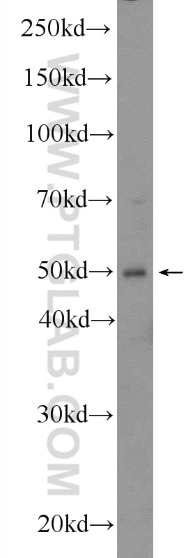 Western Blot (WB) analysis of SW 1990 cells using WIPI1 Polyclonal antibody (25204-1-AP)
