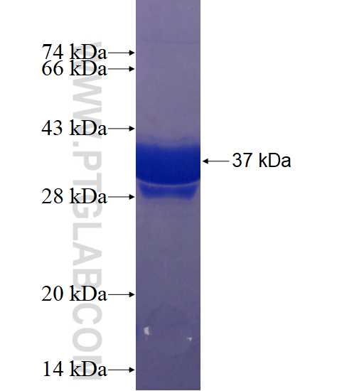 WIPI1 fusion protein Ag18461 SDS-PAGE