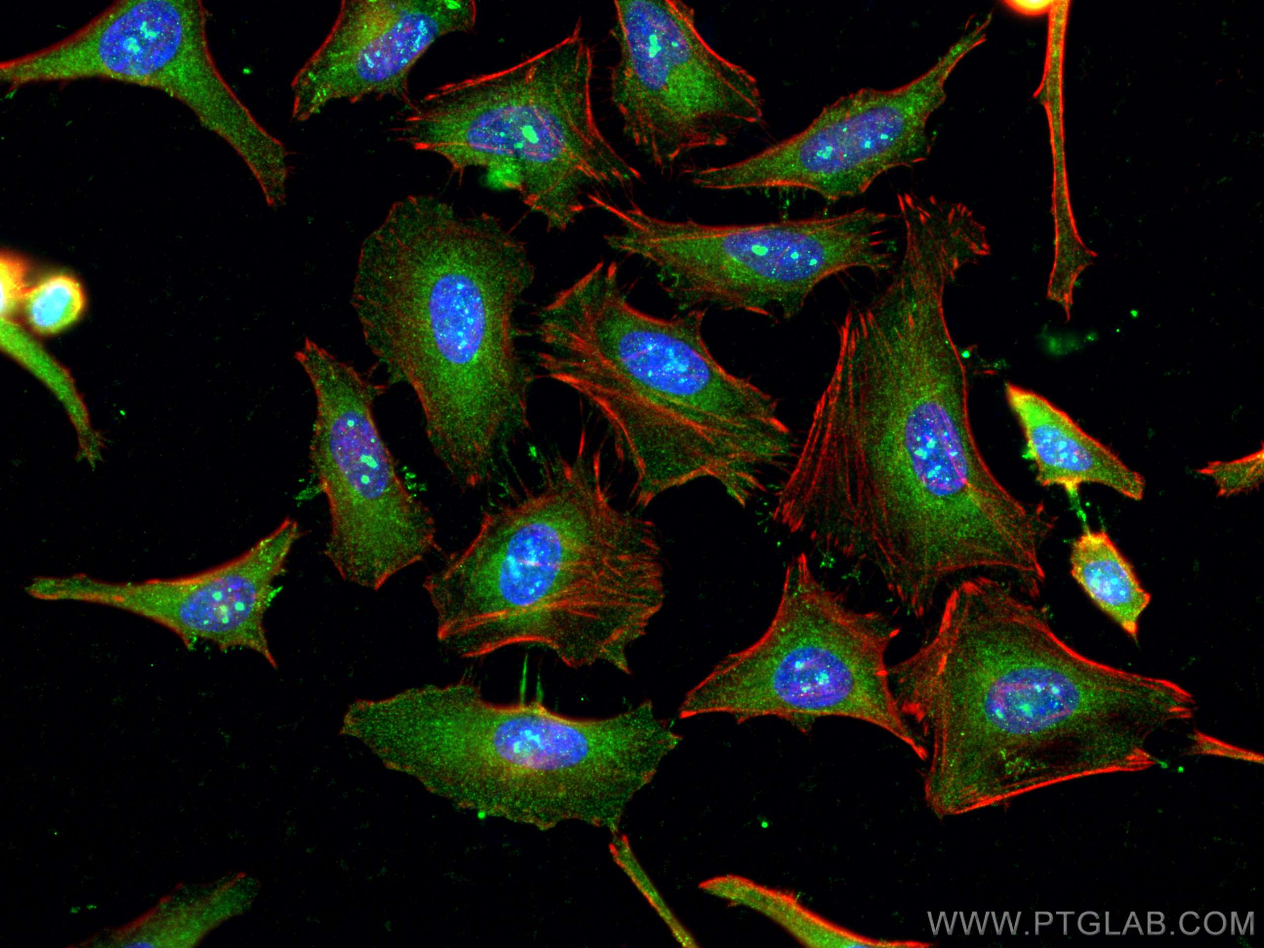 Immunofluorescence (IF) / fluorescent staining of HeLa cells using WIPI2 Polyclonal antibody (28820-1-AP)