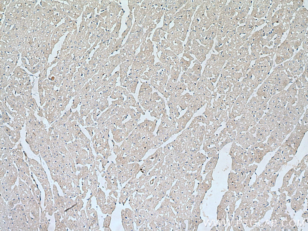 IHC staining of human heart using 28820-1-AP