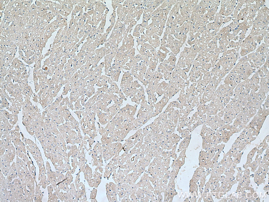 Immunohistochemistry (IHC) staining of human heart tissue using WIPI2 Polyclonal antibody (28820-1-AP)