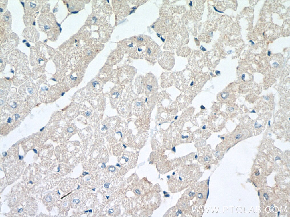 Immunohistochemistry (IHC) staining of human heart tissue using WIPI2 Polyclonal antibody (28820-1-AP)