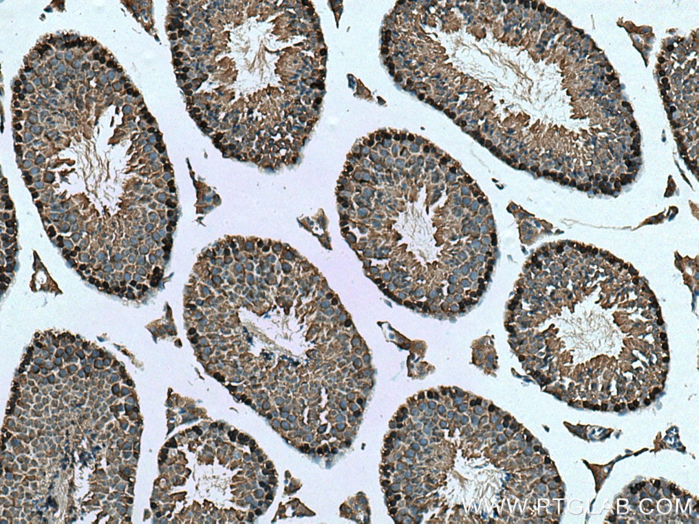 Immunohistochemistry (IHC) staining of mouse testis tissue using WIPI2 Polyclonal antibody (28820-1-AP)
