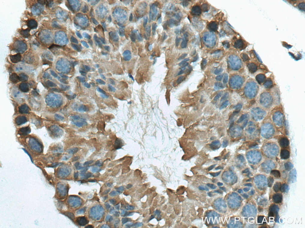 Immunohistochemistry (IHC) staining of mouse testis tissue using WIPI2 Polyclonal antibody (28820-1-AP)