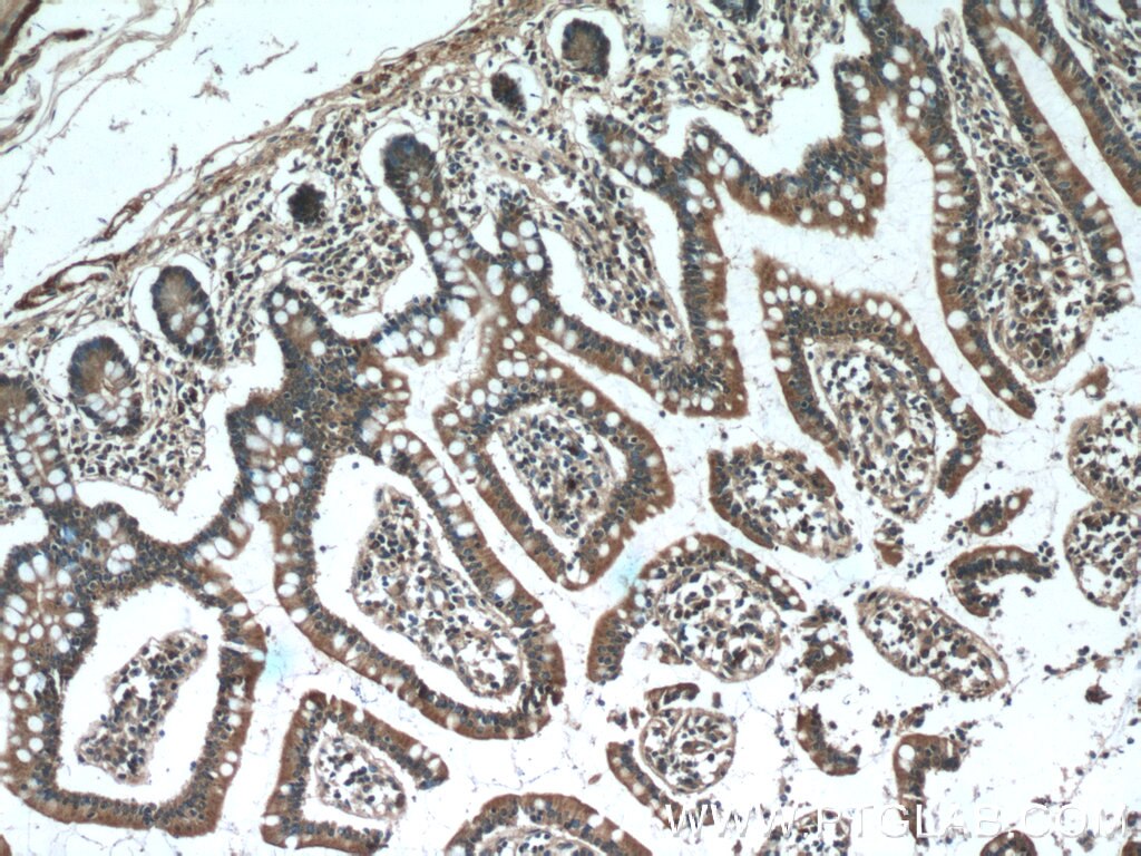 Immunohistochemistry (IHC) staining of human small intestine tissue using WISP1 Polyclonal antibody (18166-1-AP)