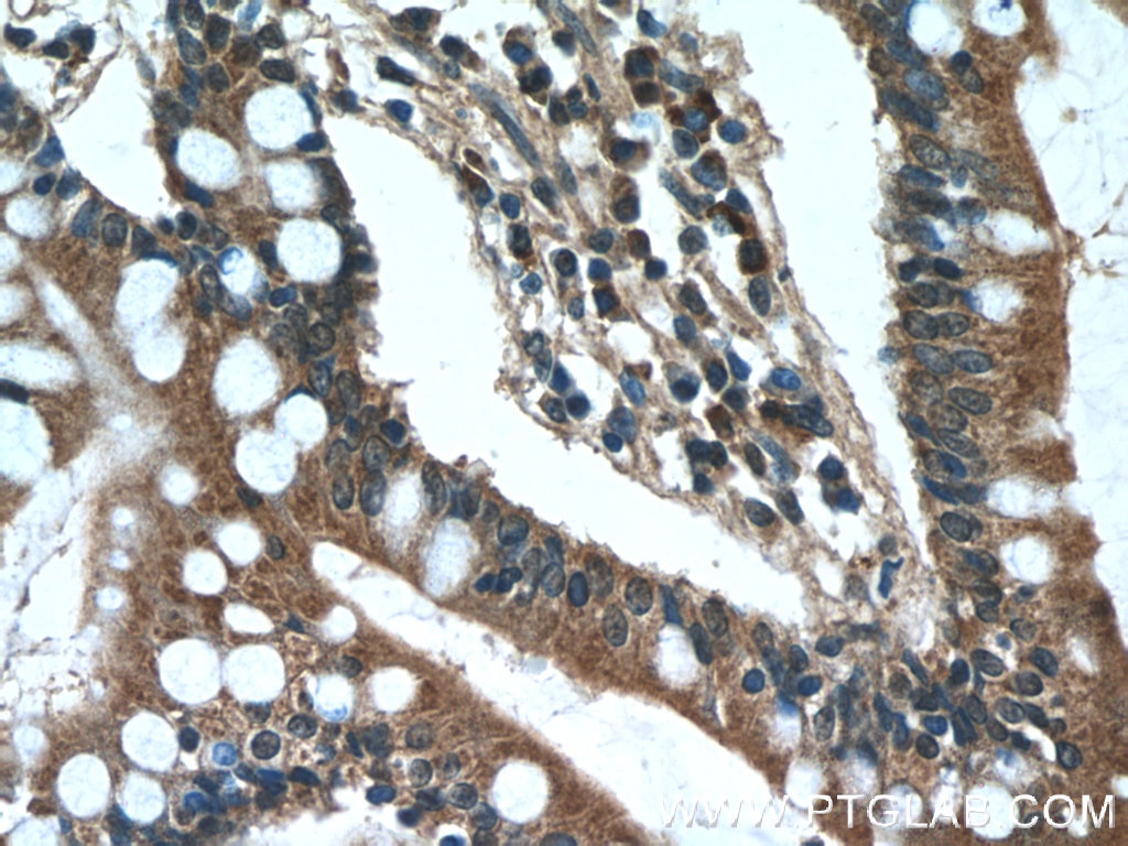 Immunohistochemistry (IHC) staining of human small intestine tissue using WISP1 Polyclonal antibody (18166-1-AP)