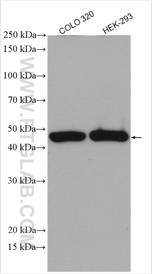 Western Blot (WB) analysis of various lysates using WISP1 Polyclonal antibody (18166-1-AP)