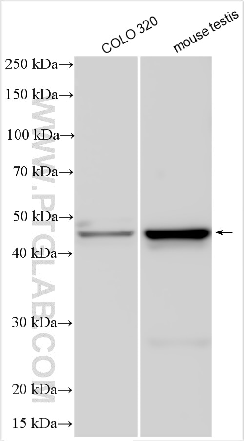Western Blot (WB) analysis of various lysates using WISP1 Polyclonal antibody (18166-1-AP)