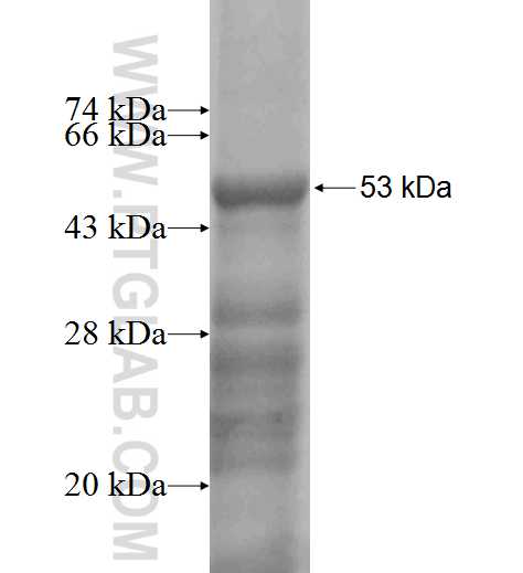 WISP2 fusion protein Ag9910 SDS-PAGE