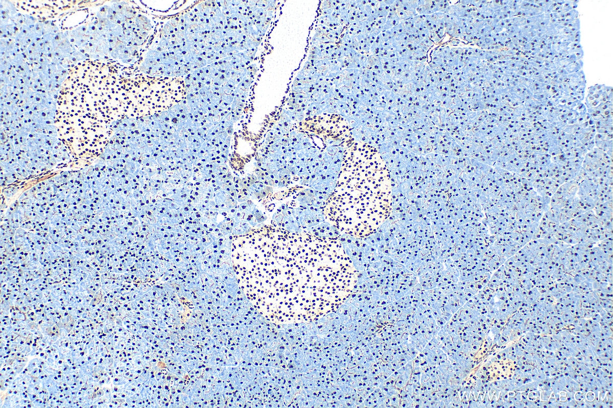 Immunohistochemical analysis of paraffin-embedded mouse pancreas tissue slide using 32378-1-AP (WIZ antibody) at dilution of 1:800 (under 10x lens). Heat mediated antigen retrieval with Tris-EDTA buffer (pH 9.0). Immunohistochemistry (IHC) staining of mouse pancreas tissue using WIZ Polyclonal antibody (32378-1-AP)