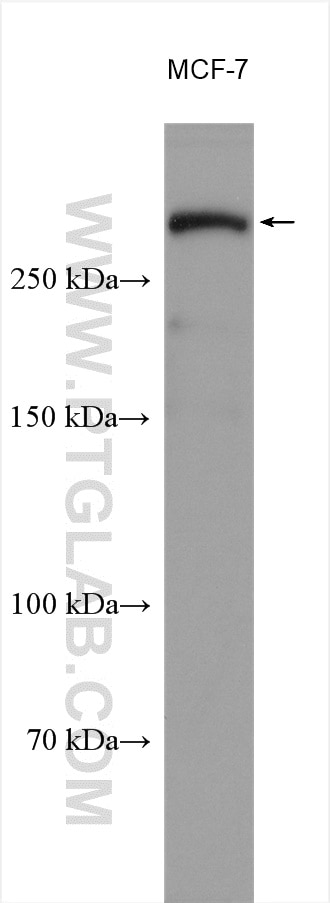 Western Blot (WB) analysis of various lysates using WNK1 Polyclonal antibody (28357-1-AP)