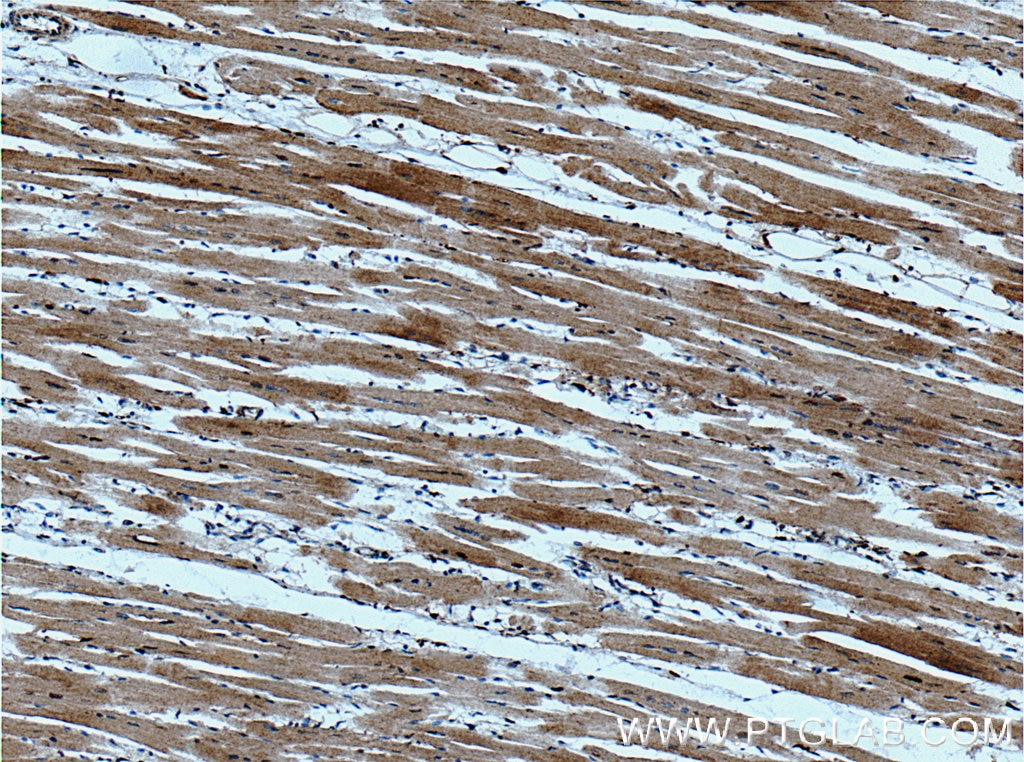 Immunohistochemistry (IHC) staining of human heart tissue using WNK2 Polyclonal antibody (22297-1-AP)