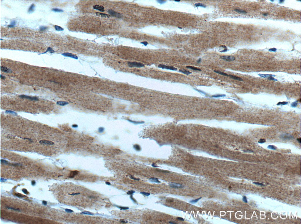 Immunohistochemistry (IHC) staining of human heart tissue using WNK2 Polyclonal antibody (22297-1-AP)