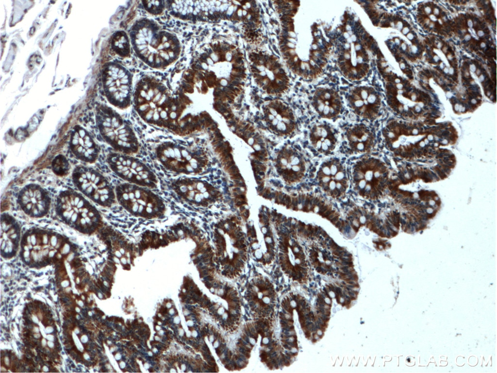 Immunohistochemistry (IHC) staining of human colon tissue using WNK4 Polyclonal antibody (22326-1-AP)
