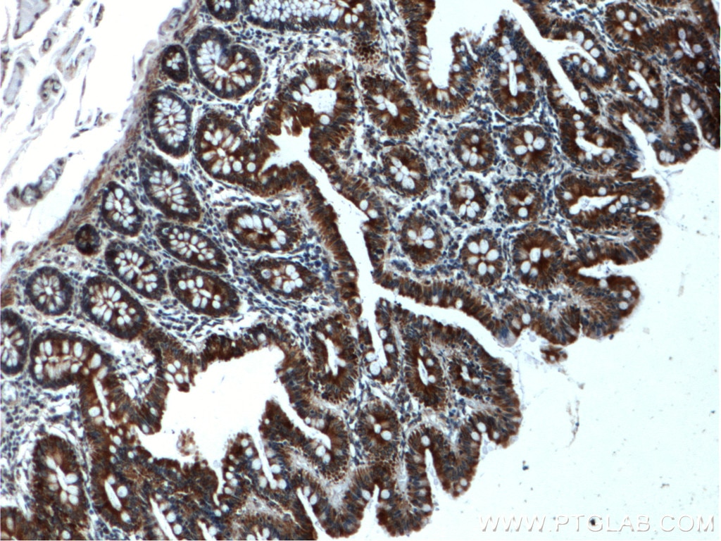 IHC staining of human colon using 22326-1-AP