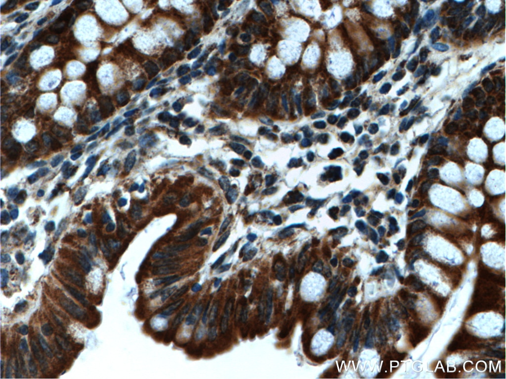 Immunohistochemistry (IHC) staining of human colon tissue using WNK4 Polyclonal antibody (22326-1-AP)