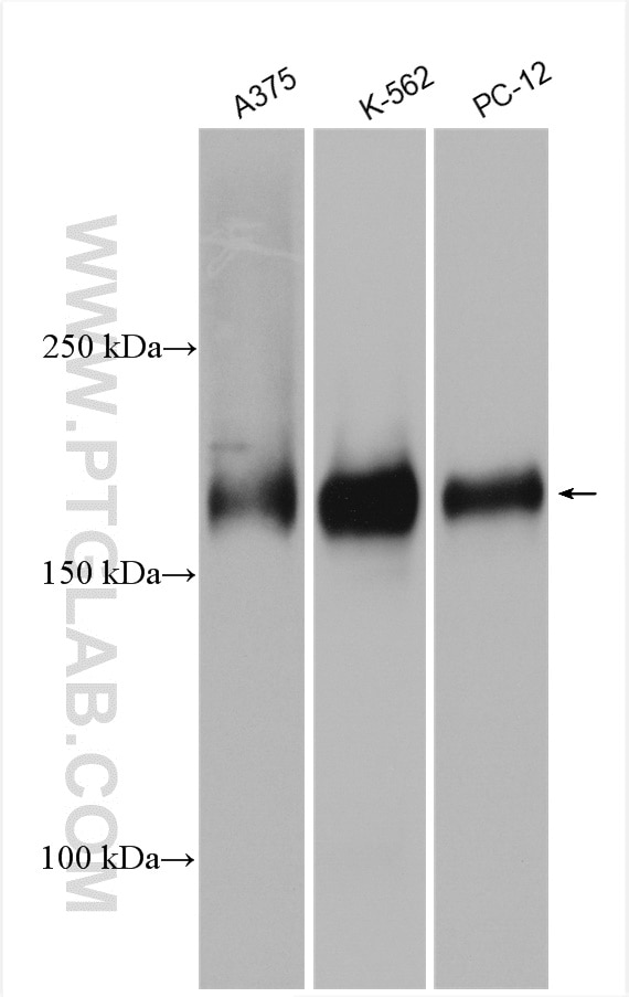 Western Blot (WB) analysis of various lysates using WNK4 Polyclonal antibody (22326-1-AP)